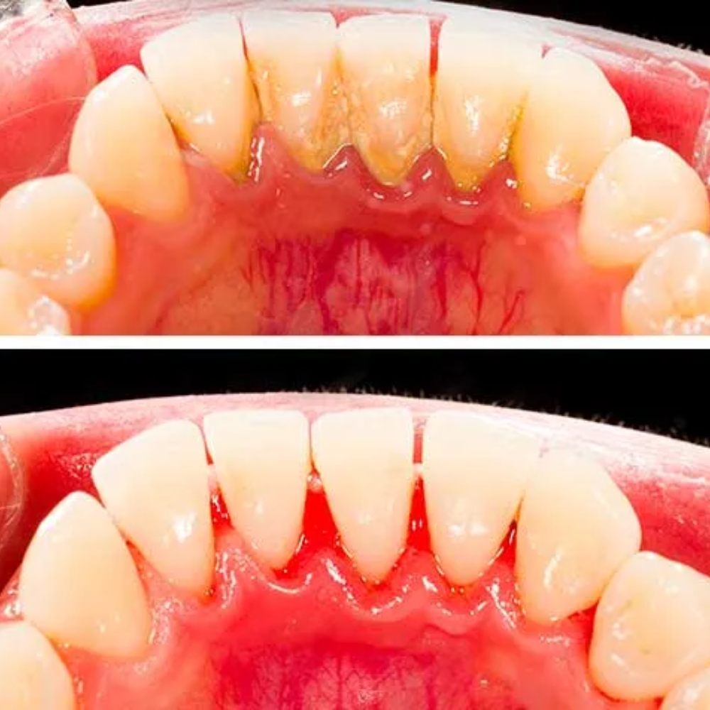 Root Canal Specialist in Mahalaxmi Nagar Indore